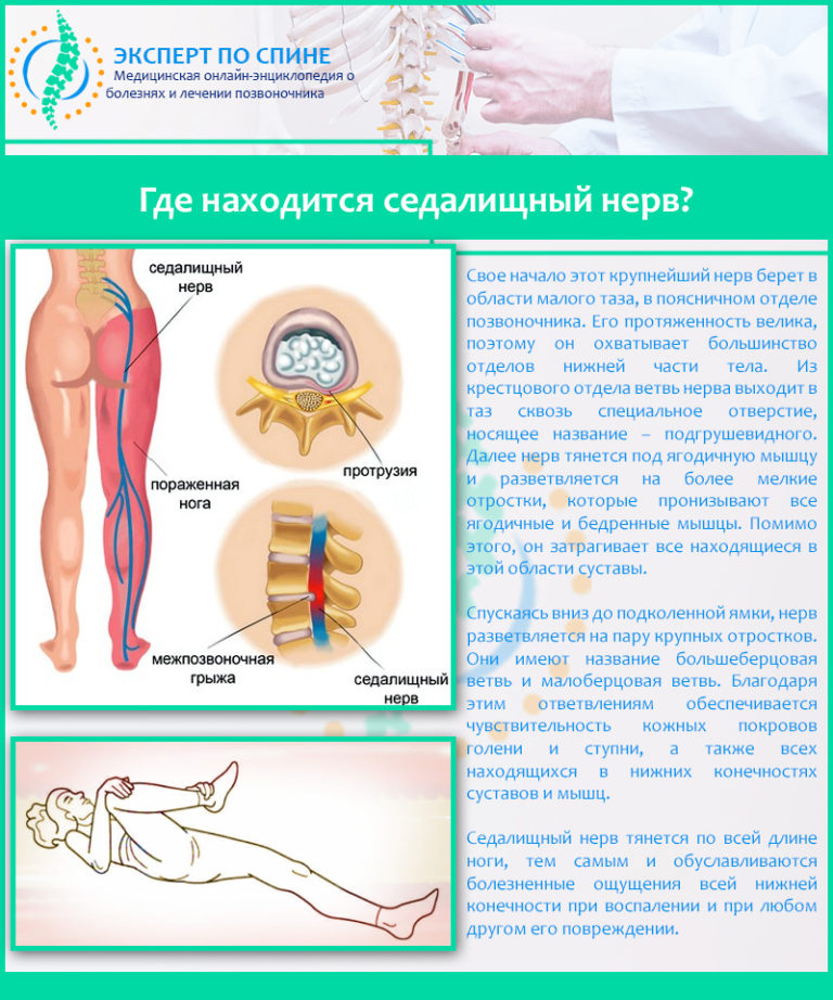 Мазь при защемлении нерва беременным 16