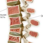 Как вылечить болезни спины
