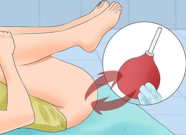 Как очистить кишечник перед рентгеном поясничного отдела thumbnail