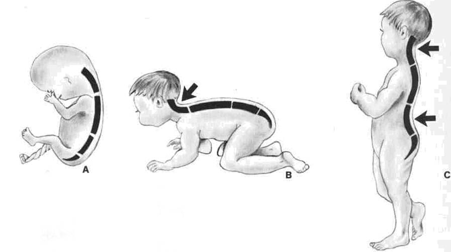 Изгибы позвоночника формируются. Лордоз позвоночника у детей. Лордоз и кифоз позвоночника у новорожденных. Лордоз позвоночника у грудничка. Шейный лордоз у новорожденного формируется.