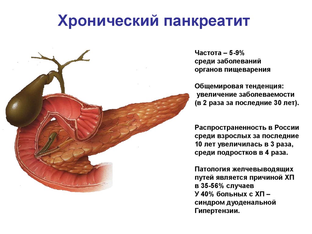 Хронический панкреатит картинки для презентации