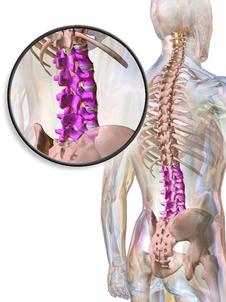 Позвоночная грыжа симптомы картинки