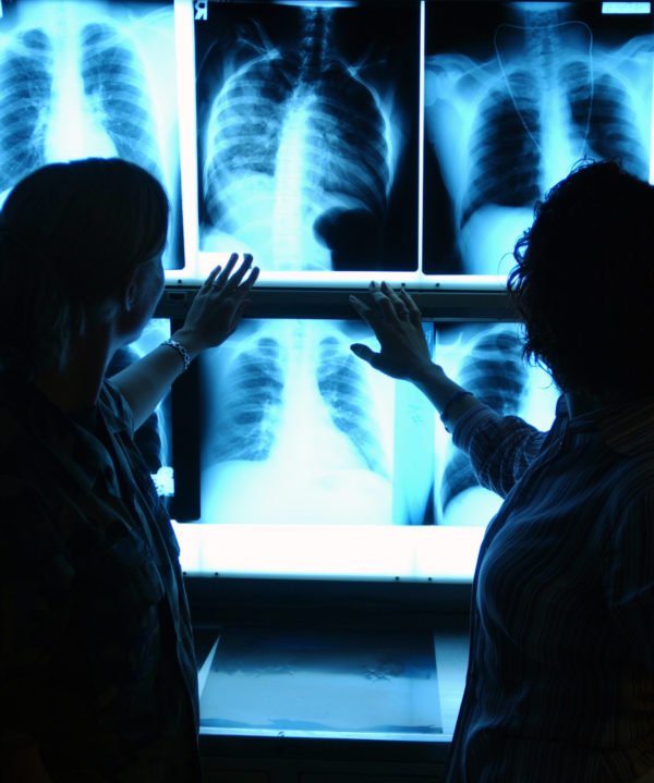 Подготовка больного к рентгенографии поясничного отдела позвоночника thumbnail