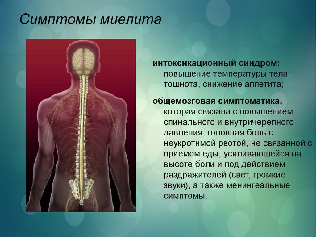Поражение спинного. Миелит неврология симптомы. Миелит спинного мозга симптомы. Миелиты - воспаление спинного мозга. Острый поперечный миелит спинного мозга грудного отдела.