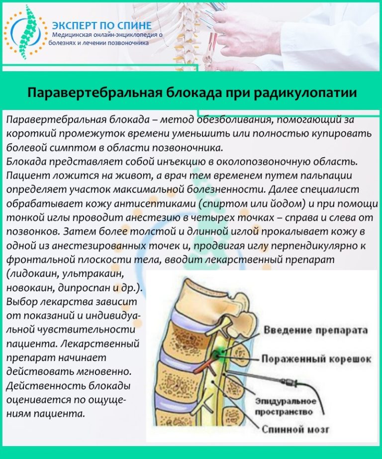 Карта вызова смп радикулопатия пояснично крестцового отдела позвоночника