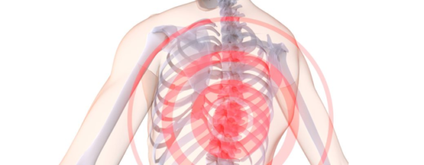 Дорсопатия грудного отдела позвоночника