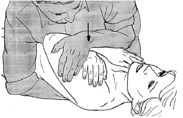 Вариант манипуляции с симметричным давлением руки и фиксация грудной клетки спереди и с боков с помощью рук пациента
