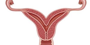 Менструационный цикл с болями в пояснице thumbnail