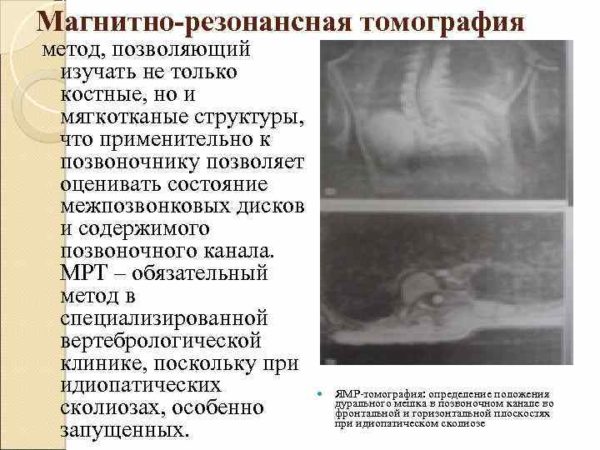 Магнитно-резонансная томография