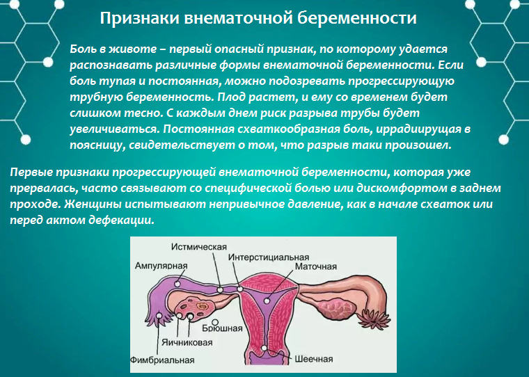 Как отличить маточное. Критерии внематочной беременности. Внематочная беременность на ранних сроках. Беременность эктопическая – внематочная беременность.. Патогенез трубной внематочной беременности.