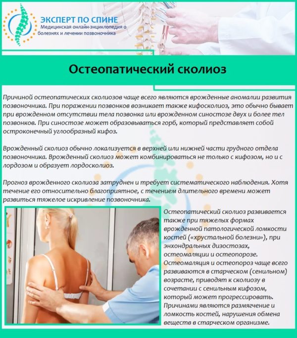 Остеопатический сколиоз 