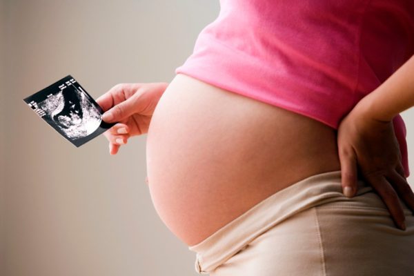 Лордоз часто наблюдается у беременных из-за повышенной нагрузки на позвоночник