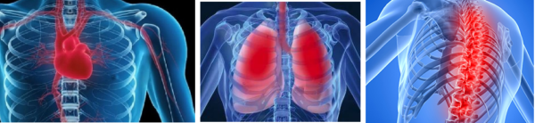Последствия грудного остеохондроза больше всего сказываются на дыхательной и сердечно-сосудистой системе