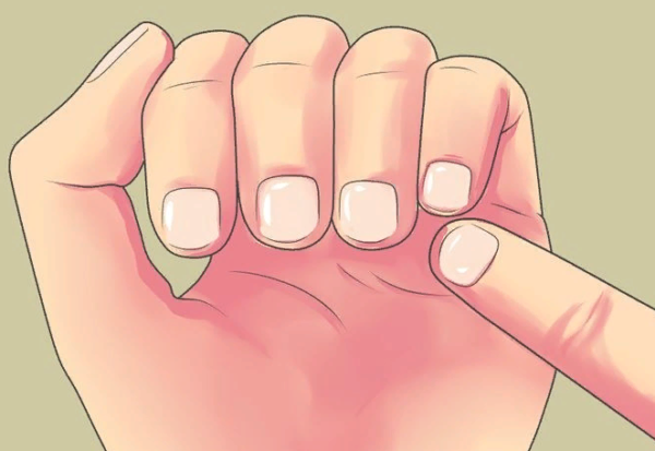 Если расслаиваются и ломаются ногти, важно исключить грибок