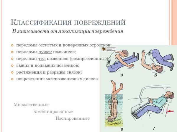 Классификация повреждений позвоночника