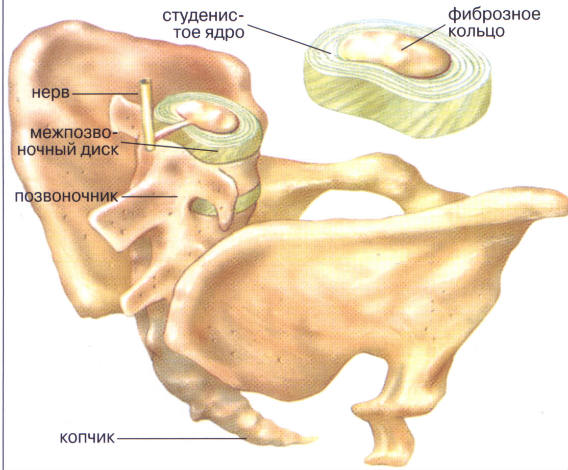 Фиброзное кольцо межпозвоночного диска