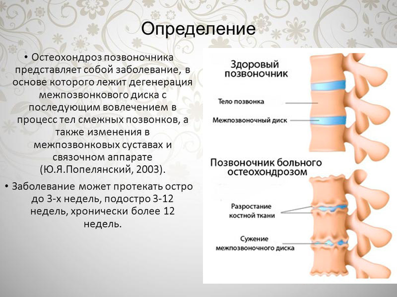 Клиническая картина остеохондроза позвоночника