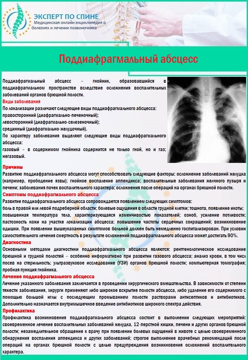 Немеет спина. Поддиафрагмальный абсцесс. Причины поддиафрагмального абсцесса. Поддиафрагмальный абсцесс диагностика. Симптомы, характерные для поддиафрагмального абсцесса.