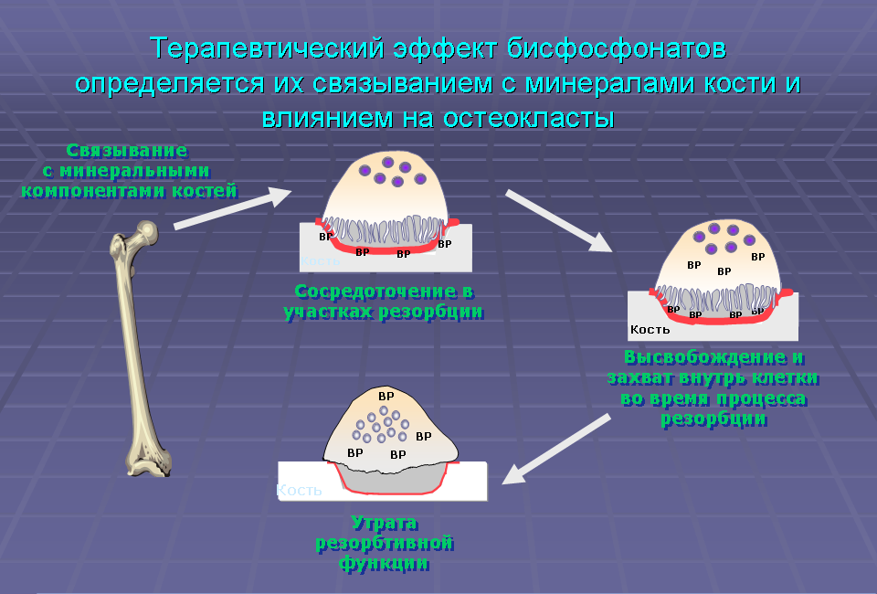 Бисфосфонаты для лечения. Бисфосфонаты для костей лекарства. Механизм действия остеокластов. Механизм действия бисфосфонатов. Биофосфаты при остеопорозе.