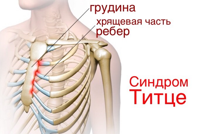 За грудина у человека где находится фото