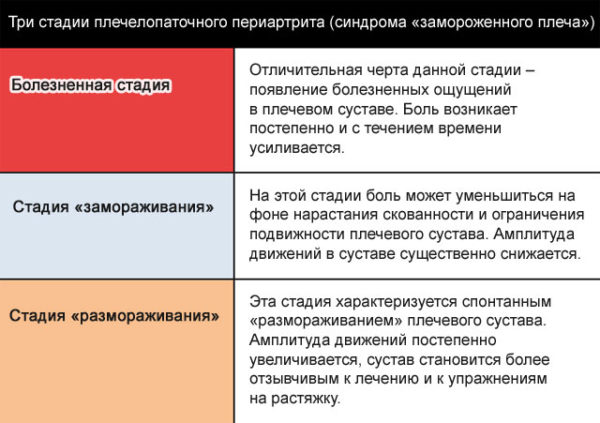 Три стадии плечелопаточного периатрита