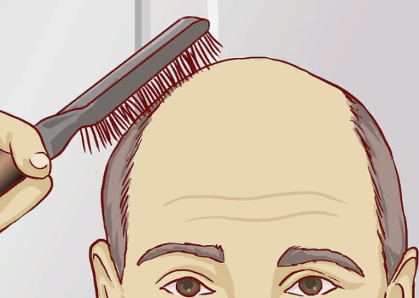 Вторичным симптомом может быть выпадение волос