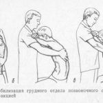 Мобилизация грудного отдела позвоночного столба, в сочетании с тракцией