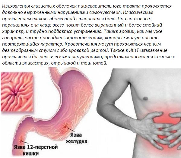 Как снять боль при язве желудка быстро Как колоть "Диклофенак" при болях в пояснице: подробная инструкция