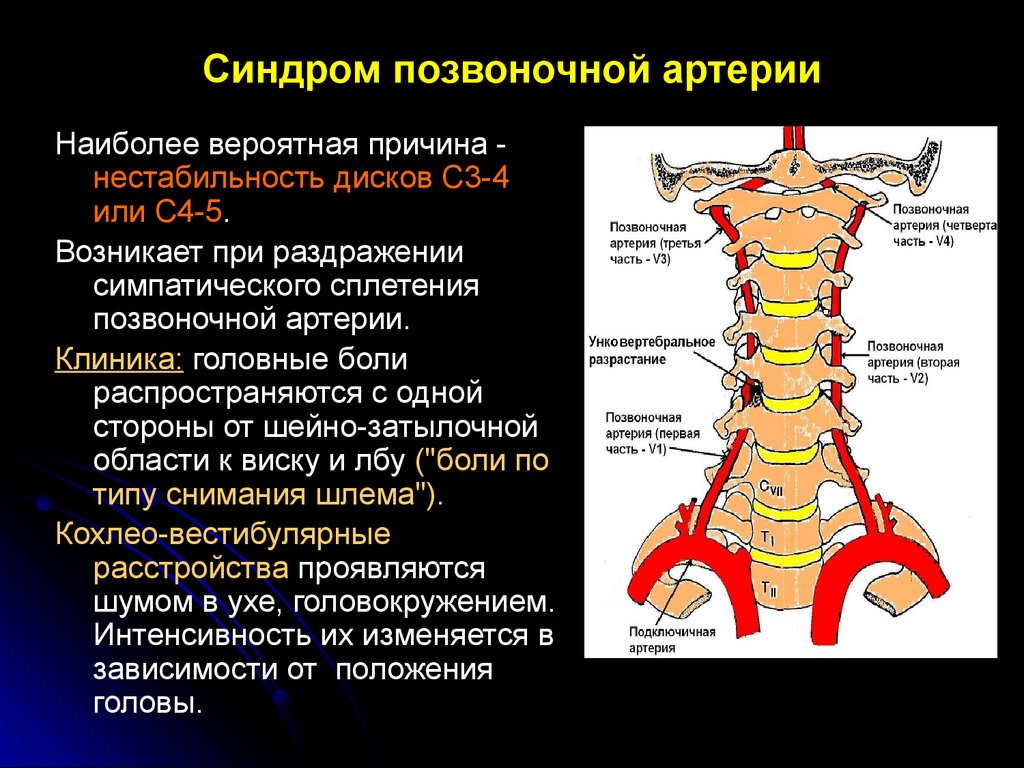 Нарушение работы вертебральных артерий при СПА может и не привести к ишемии мозга, но существует риск возникновения других патологий