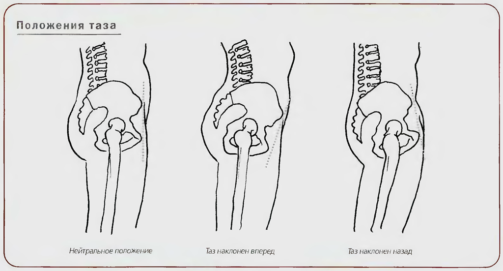 Положение таза. Правильное положение крестца. Нормальное положение таза. Наклон таза.