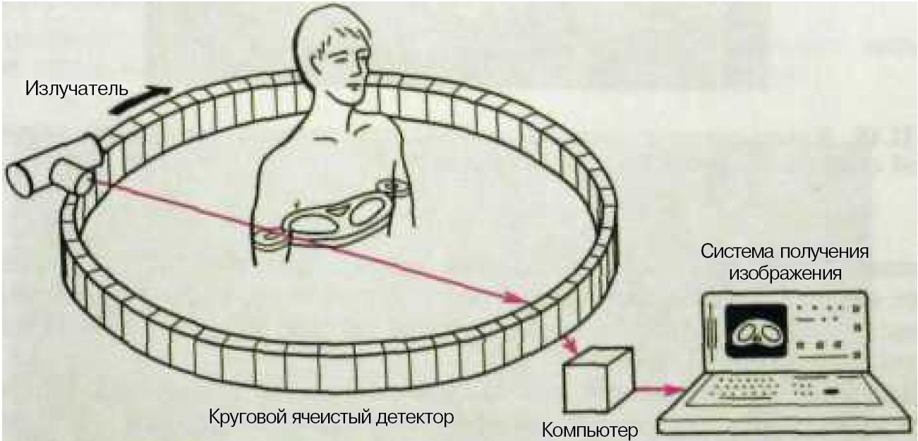 Схема получения изображения мрт