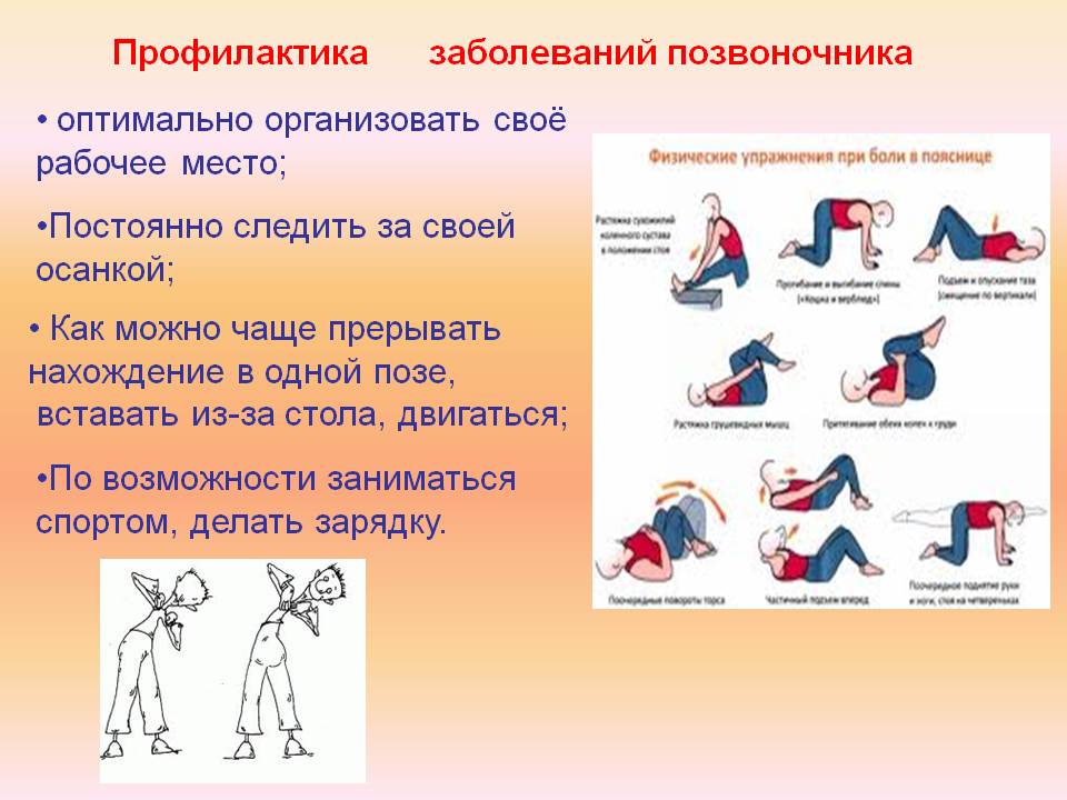 Профилактика остеохондроза презентация