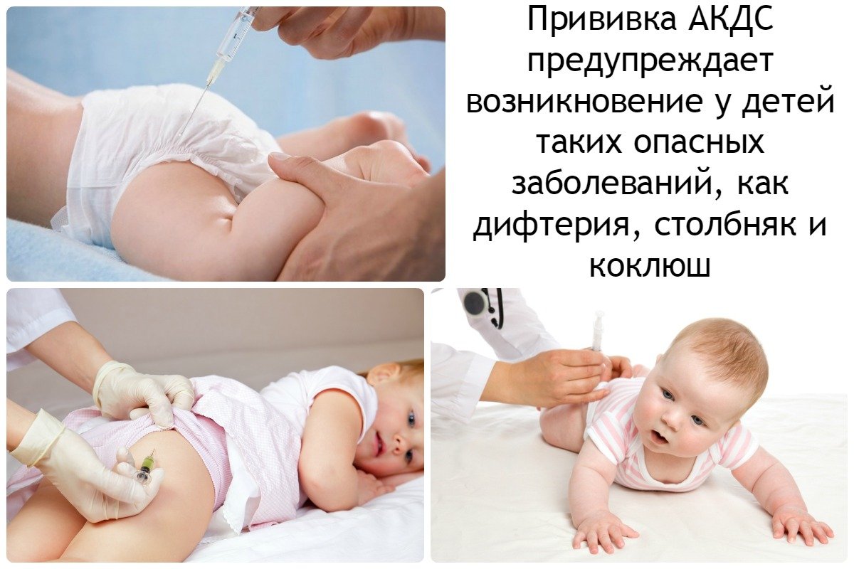 Вакцинация коклюш схема