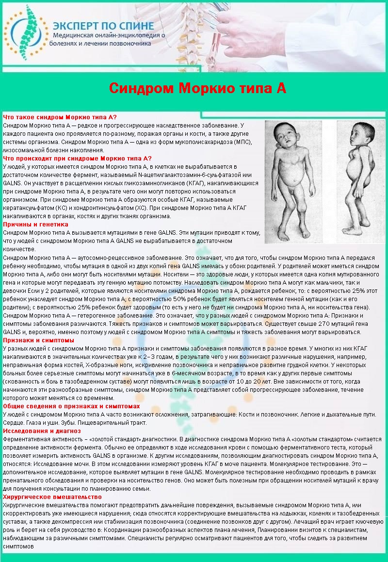 Дисплазия позвоночника у детей симптомы и лечение thumbnail