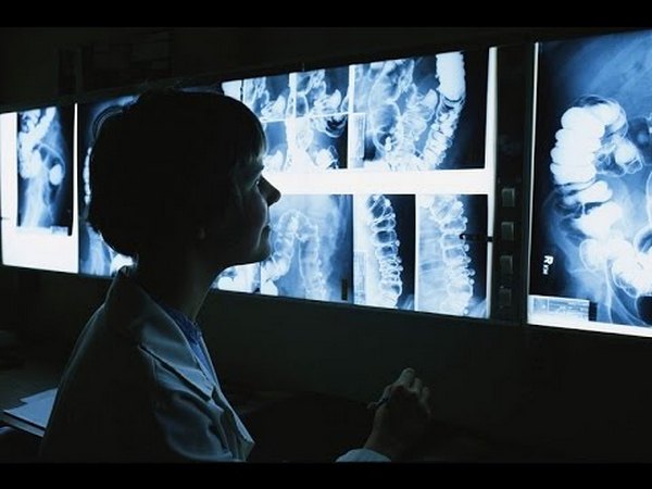 Рентгенография основана на прохождении рентгеновских лучений через ткани организма, благодаря чему вырисовывается «картина» происходящего