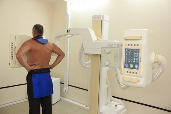 В настоящее время существует два типа рентген-аппаратов – пленочный и цифровойВ настоящее время существует два типа рентген-аппаратов – пленочный и цифровой