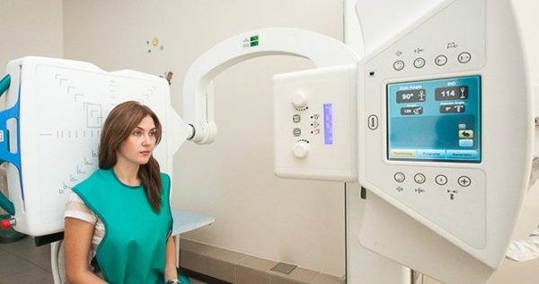 Традиционный способ диагностики - рентгенография шейного отдела