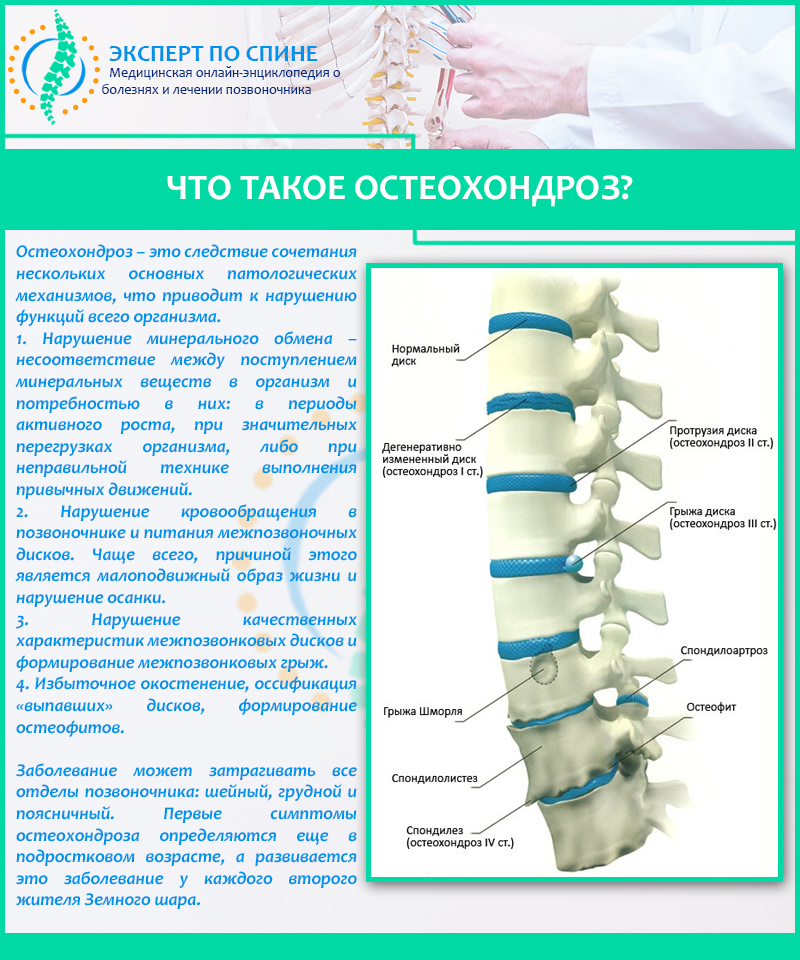 Клиническая картина метастатического поражения позвоночника отличается от остеохондроза