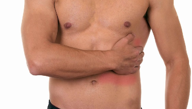 Межреберная невралгия – код по МКБ-10 - причины, симптомы и методы лечения