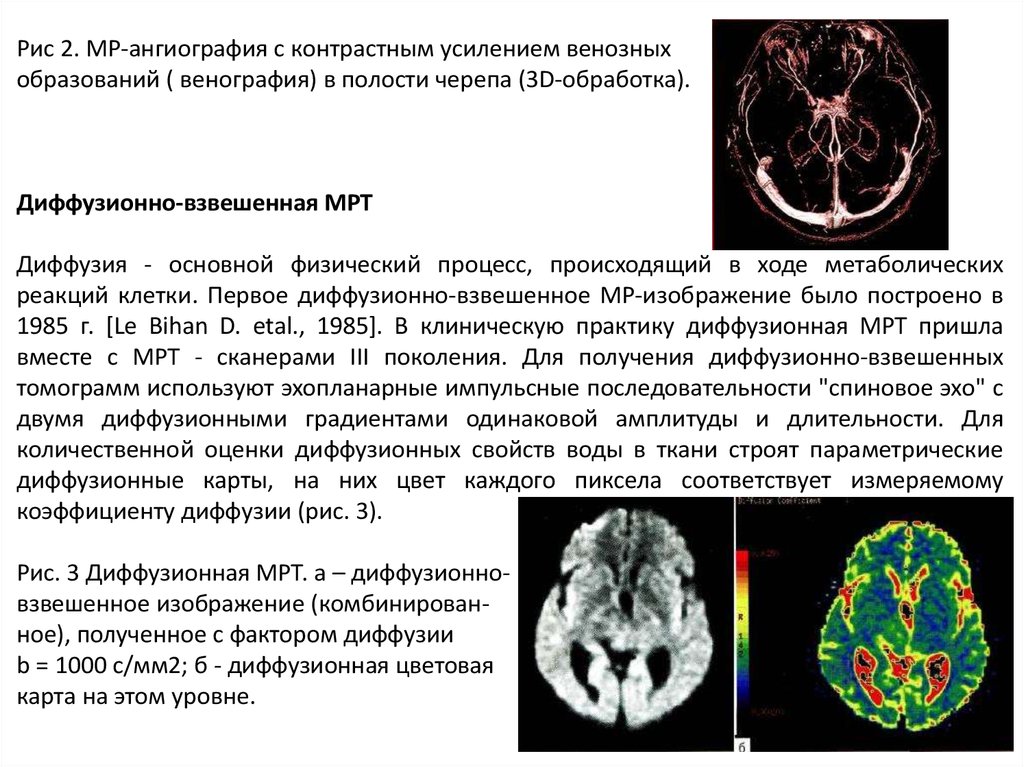 Диффузионно взвешенное изображение